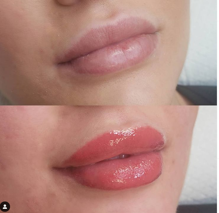 Lip Before  Aftercare Instructions  glambygeegee